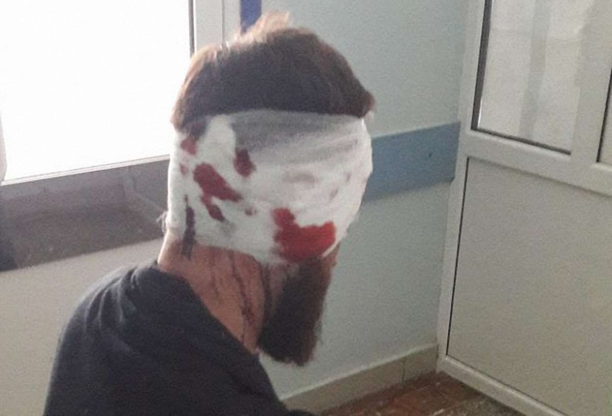 У Харкові побили 34-річного депутата облради від «Самопомочі»