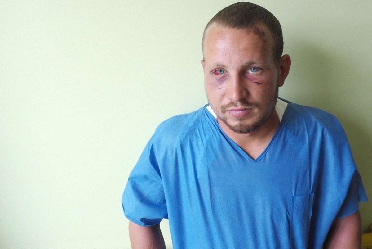 Поляки за добу зібрали ₴100 тис. на лікування побитого в Любліні українця