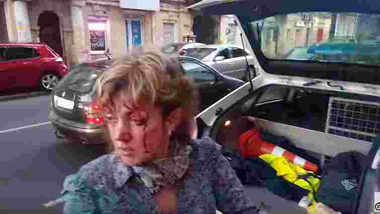 В Одесі побили проукраїнську активістку  Аліну Радченко