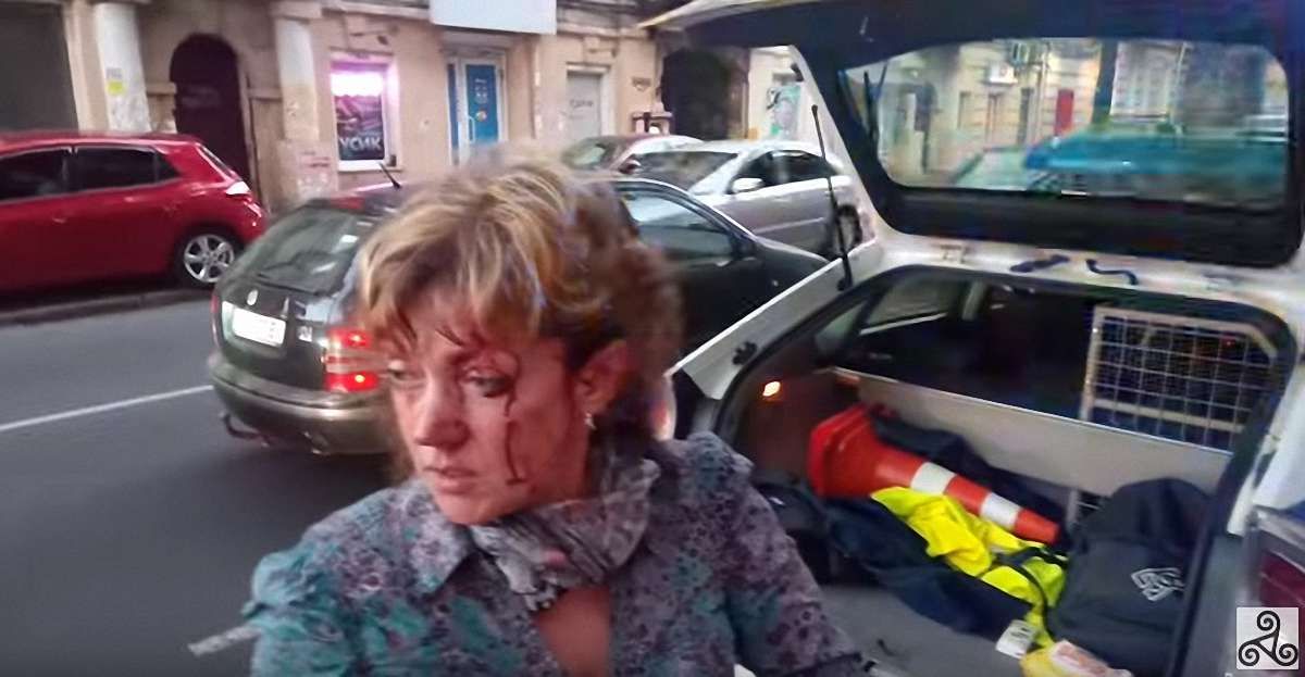 В Одесі побили проукраїнську активістку  Аліну Радченко
