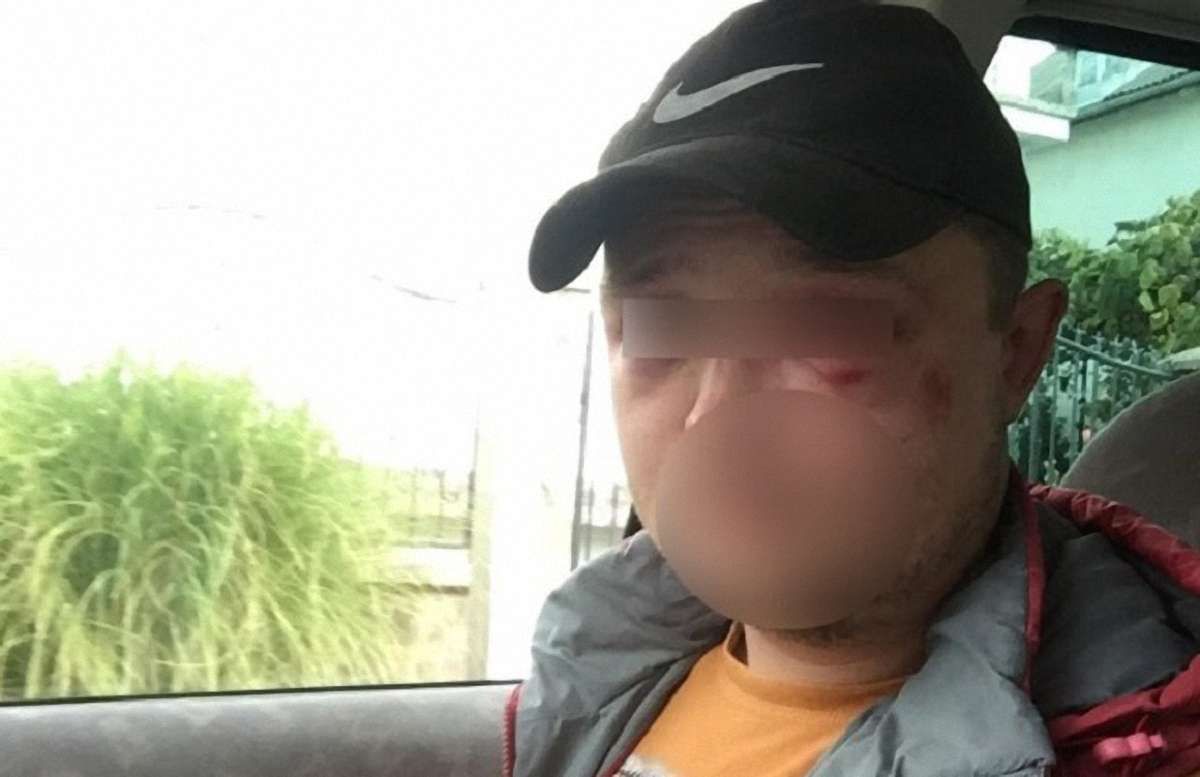 На Закарпатті жителі села побили заїжджих грибників