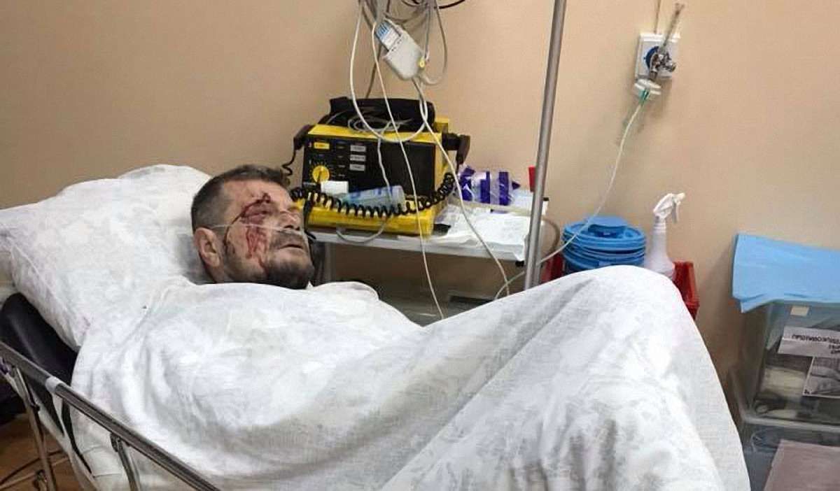 На нардепа Ігоря Мосійчука скоїли замах у Києві