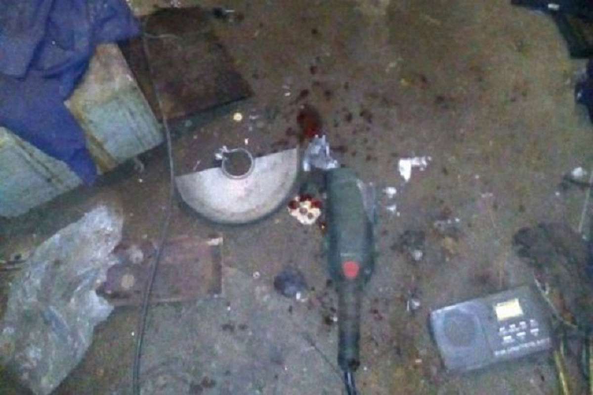 На Донбасі чоловік отримав поранення при спробі розпиляти снаряд від зенітки