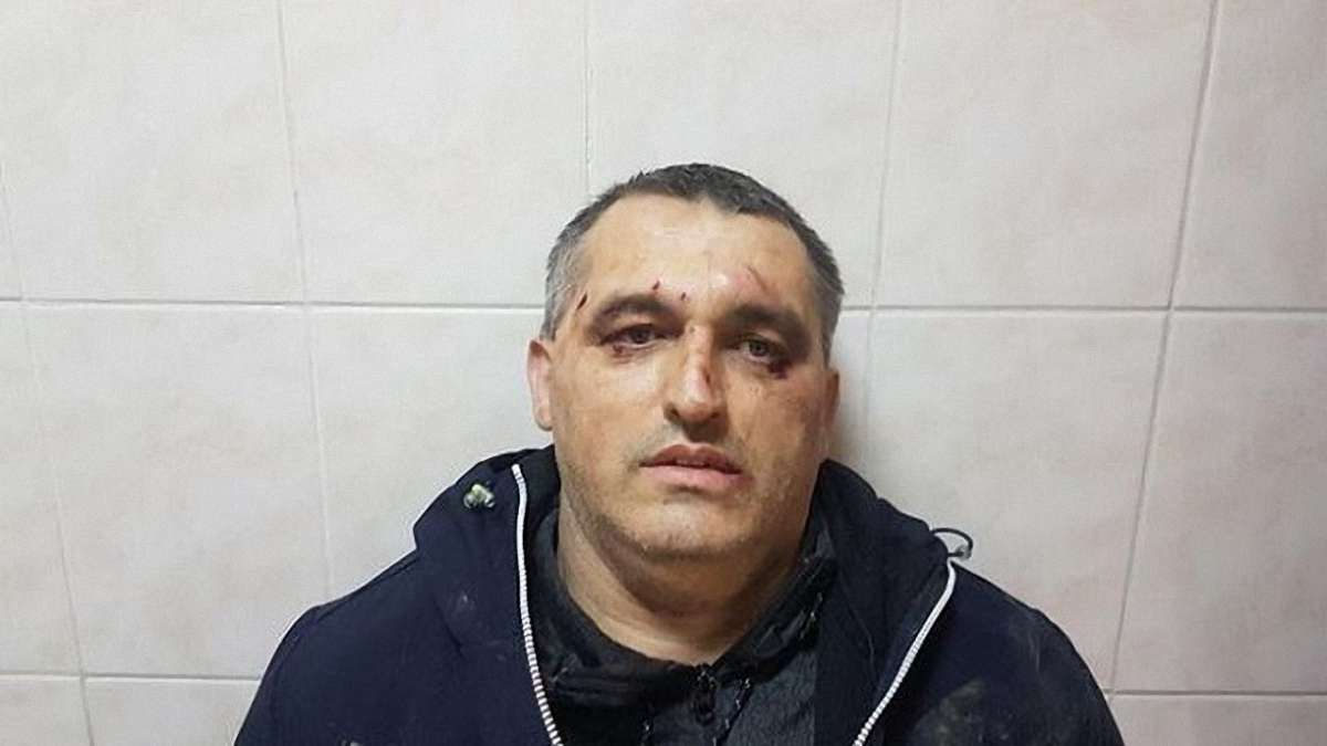 У Чернівцях невідомі побили активіста руху «Стоп корупції»