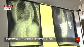 Польські ортопеди прооперували трьох львівських дітей із вадами хребта