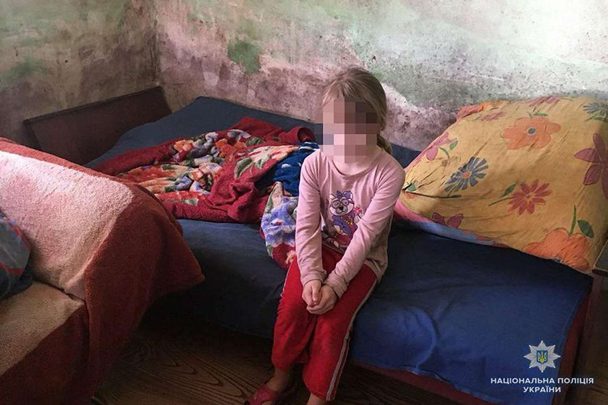 На Тернопільщині мати побила 9-річну доньку через скарги на зубний біль