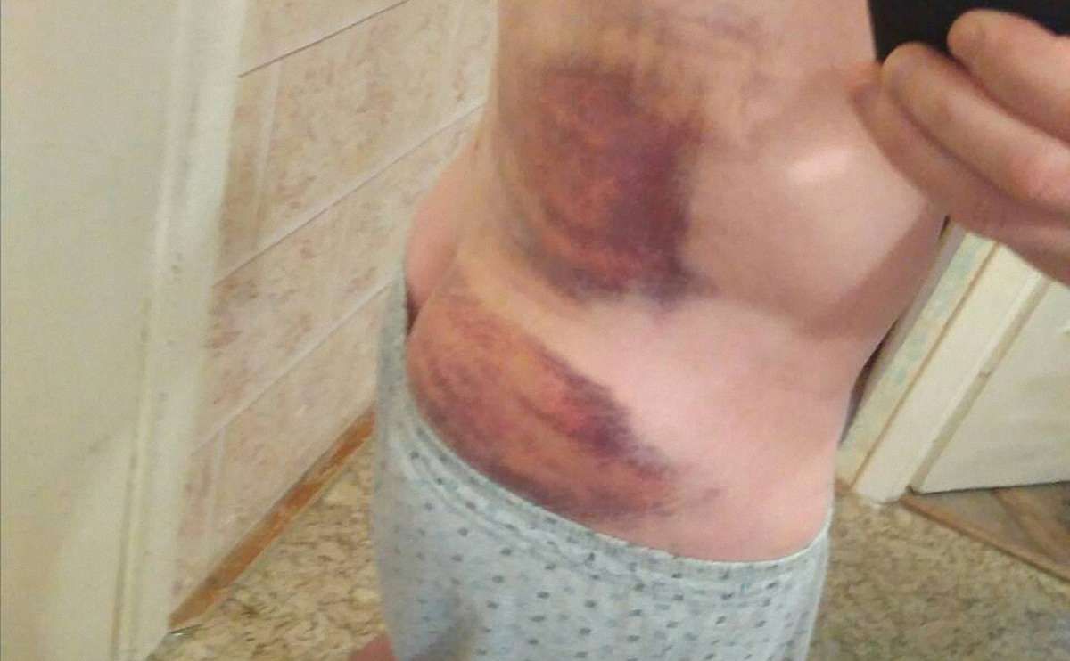 Через скандал із побиттям затриманого у львівській поліції почали службове розслідування