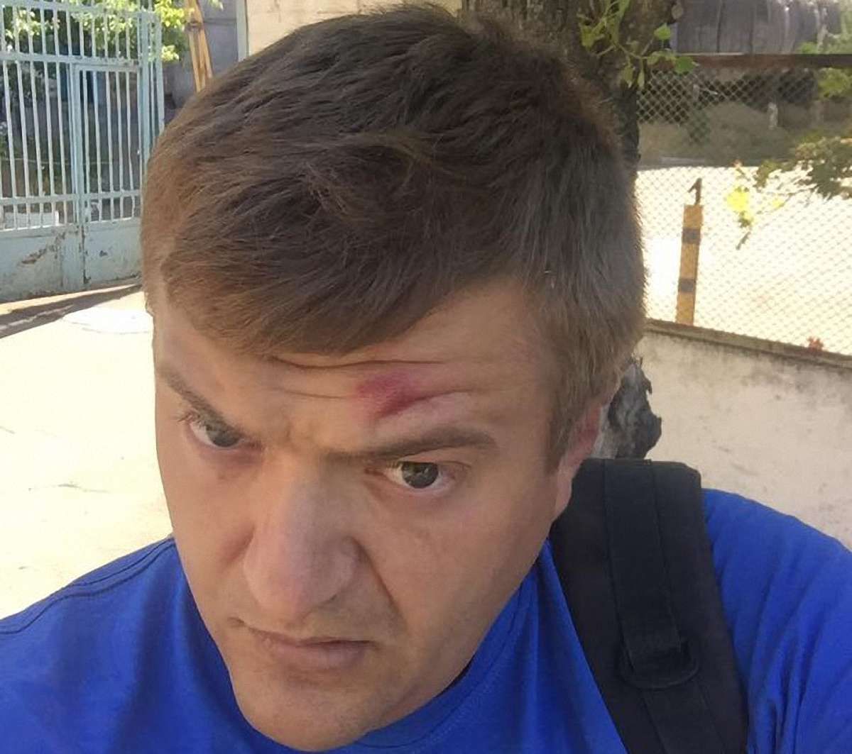 У Херсоні невідомі зловмисники напали на журналіста