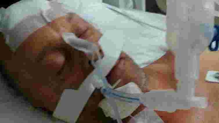 П’яний росіянин жорстко побив українця у турецькому готелі через виліт Росії з ЧС-2018
