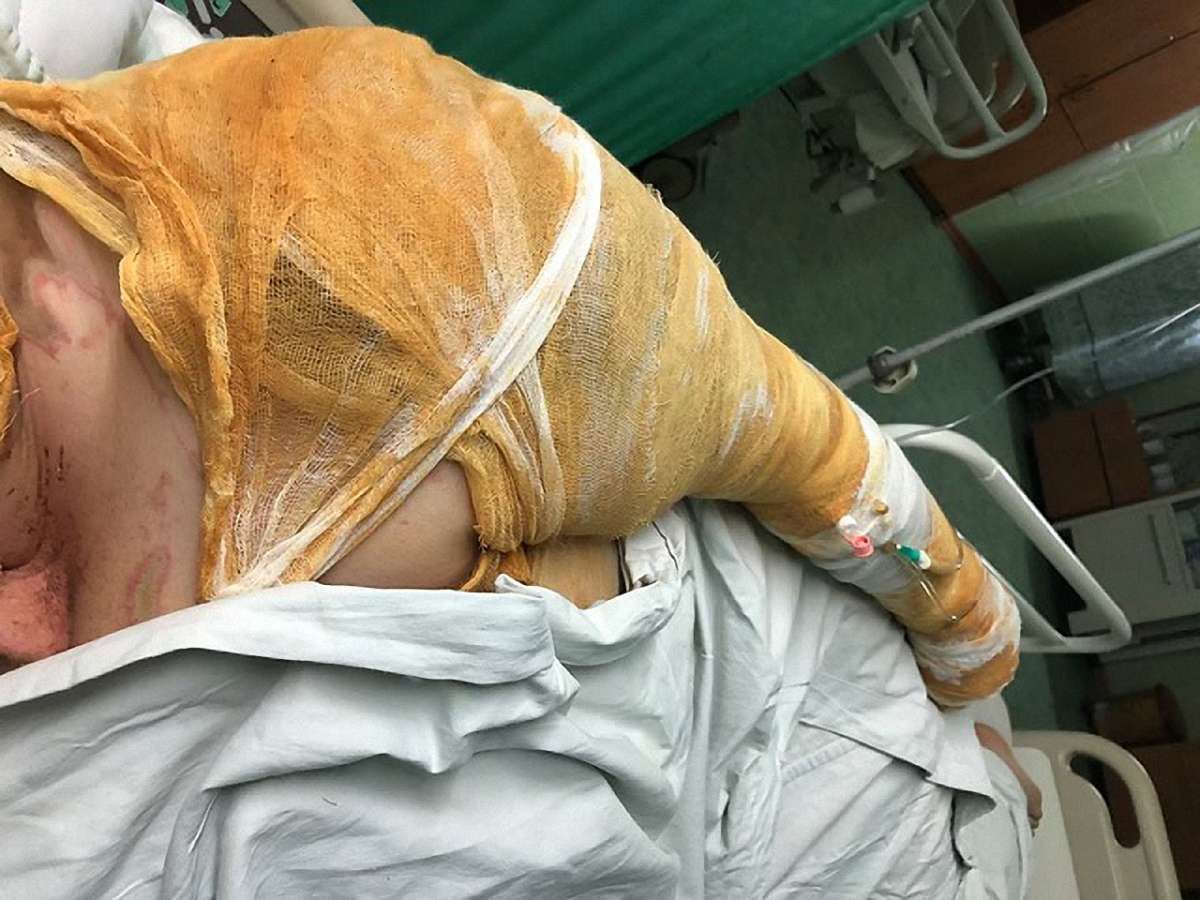Аваков заявив про затримання підозрюваного в замаху на вбивство радниці мера Херсона