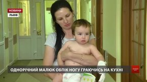 У Львові стартувала профілактична кампанія проти дитячих опіків