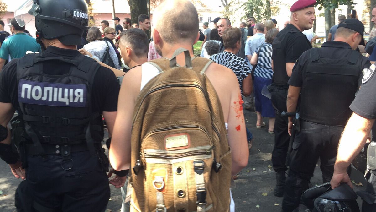 Активісти партії «За життя» пікетували ЛОДА. Їх закидали помідорами