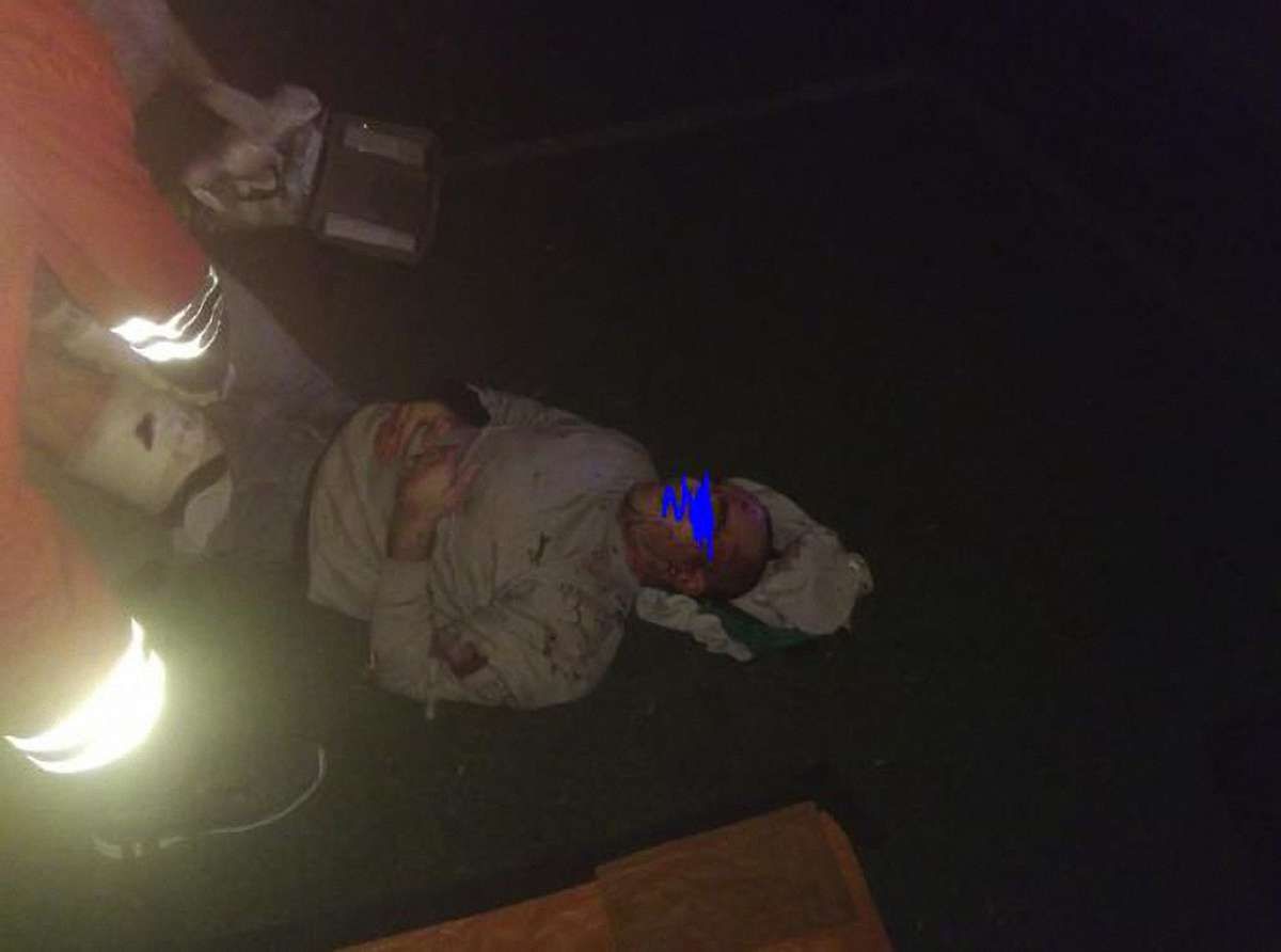 Після нападу невідомих у Львові госпіталізували трьох анархістів з ножовими пораненнями