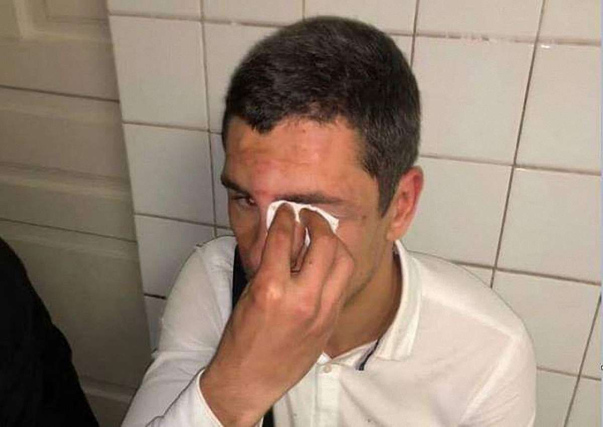 У Києві побили голову молодіжного осередку «Радикальної партії»