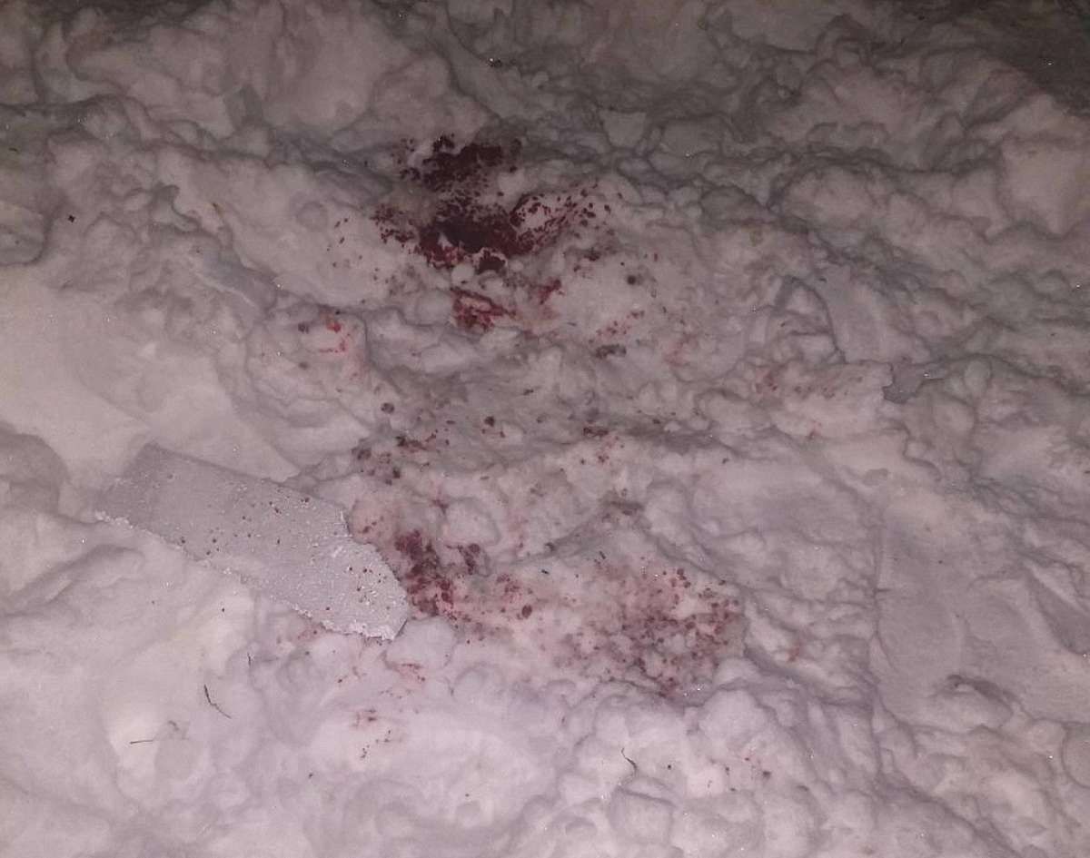 34-річний харків'янин втратив кисть руки під час запуску феєрверку