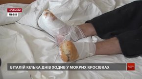 Сімом пацієнтам львівської лікарні загрожує ампутація через обмороження