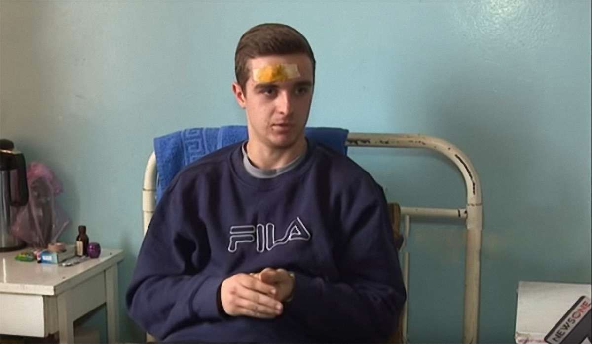 На Дніпропетровщині в руках 18-річного хлопця вибухнула електронна сигарета