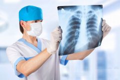 У Львові минулого тижня від пневмонії померло четверо хворих