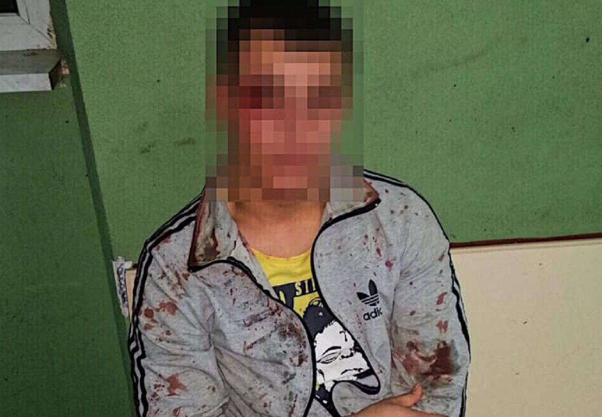 Патрульні затримали чоловіків, які напали на 20-річного хлопця у Винниках