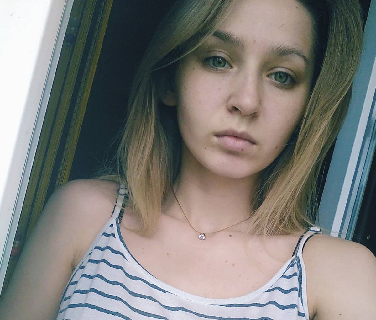У лікарні померла 21-річна львів'янка, яку тиждень тому на переході збила машина