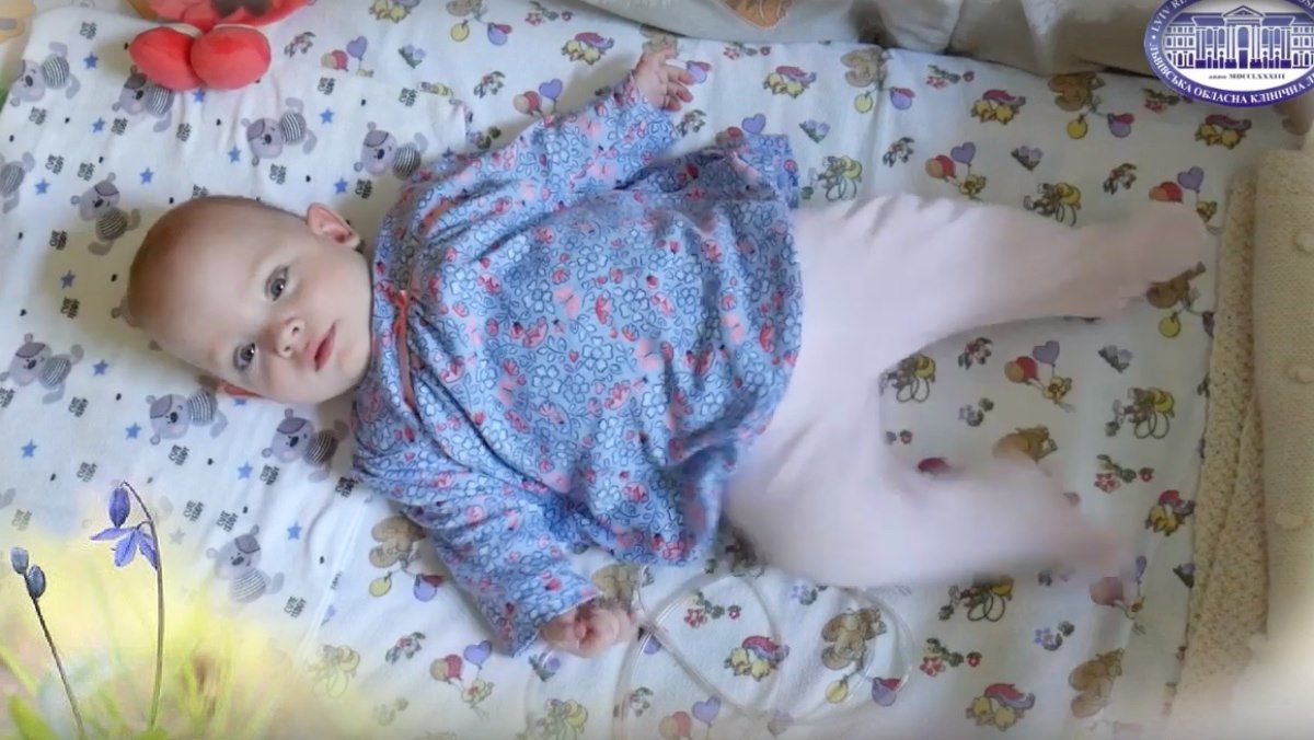 Львівські неонатологи вперше виходили дитину з вагою 480 грамів