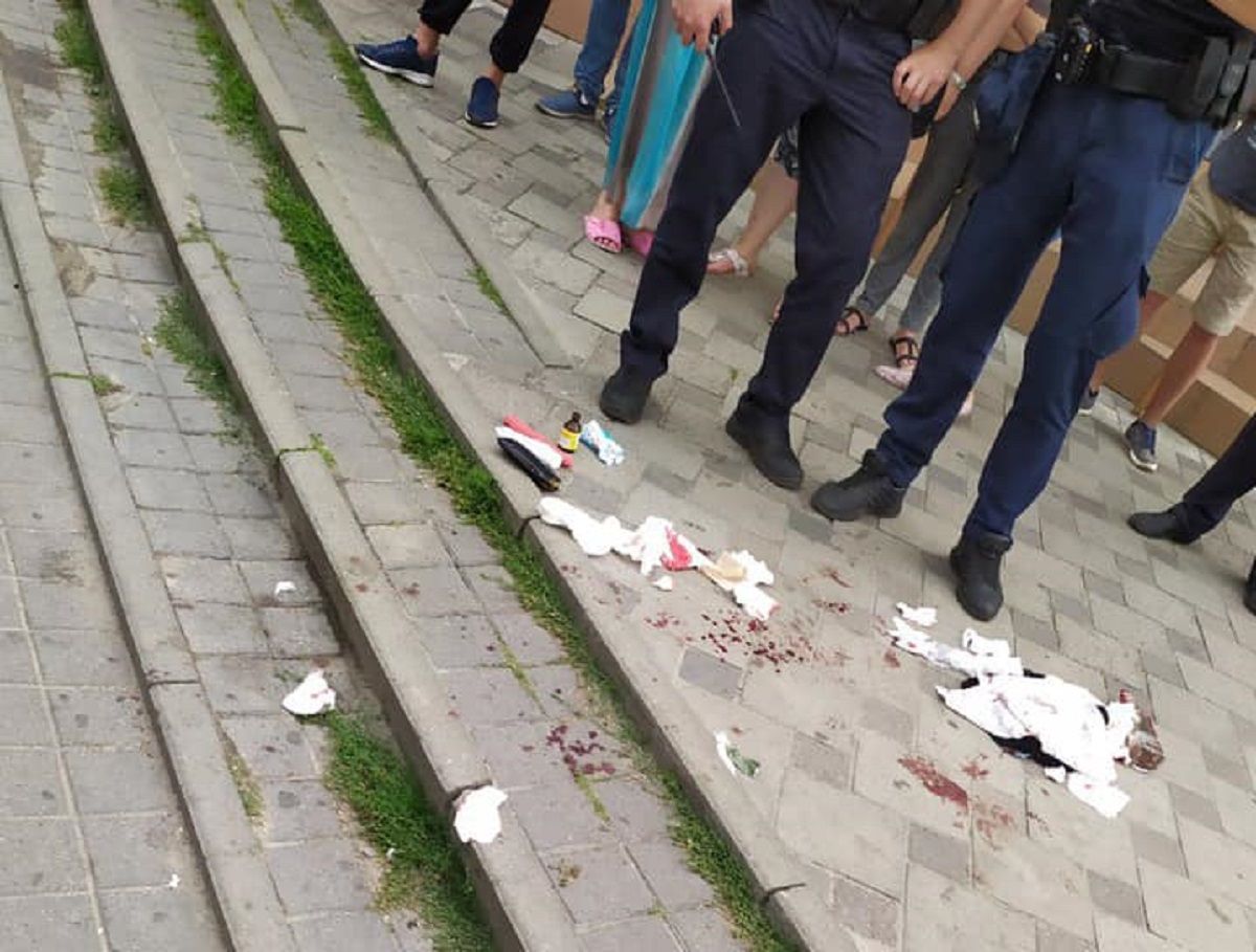 Посеред дня у центрі Львова ножем поранили перехожого