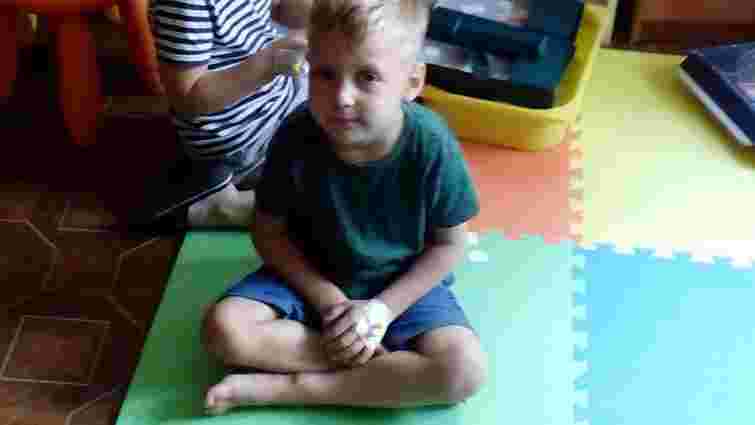 У 4-річного хлопчика з Новояворівська лікарі видалили рідкісний поліп