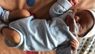 Львівські хірурги успішно видалили одноденному немовляті гігантську пухлину вагою майже 2,5 кг