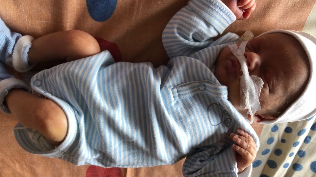 Львівські хірурги успішно видалили одноденному немовляті гігантську пухлину вагою майже 2,5 кг