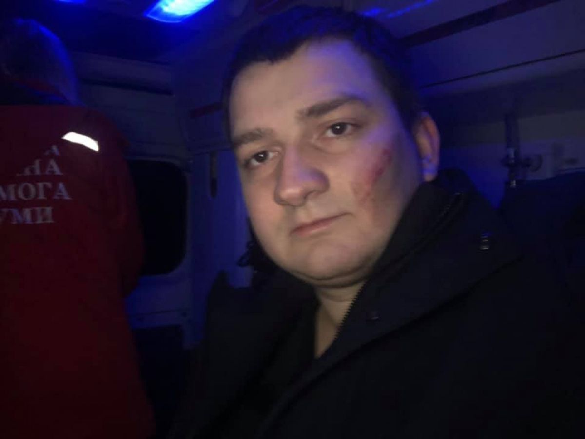 Напад на депутата «Слуги народу» Михайла Ананченка виявився інсценізацією СБУ