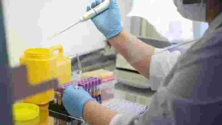 До кінця тижня Львів отримає тест-системи для діагностування коронавірусу