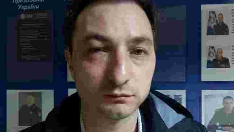 У Києві напали на головного лікаря Інституту раку Андрія Безносенка