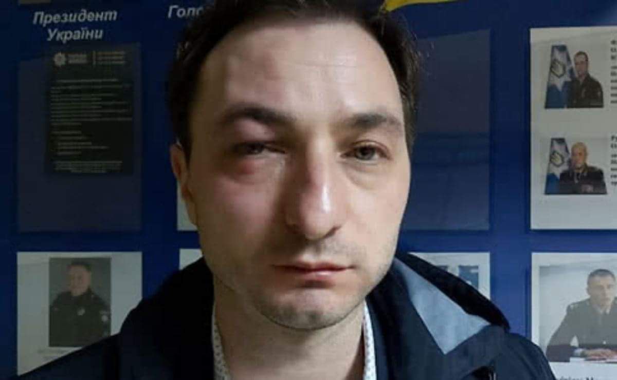 У Києві напали на головного лікаря Інституту раку Андрія Безносенка