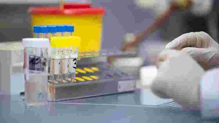 ЛМР передасть обласній лабораторії 20 наборів реагентів для тестування на коронавірус