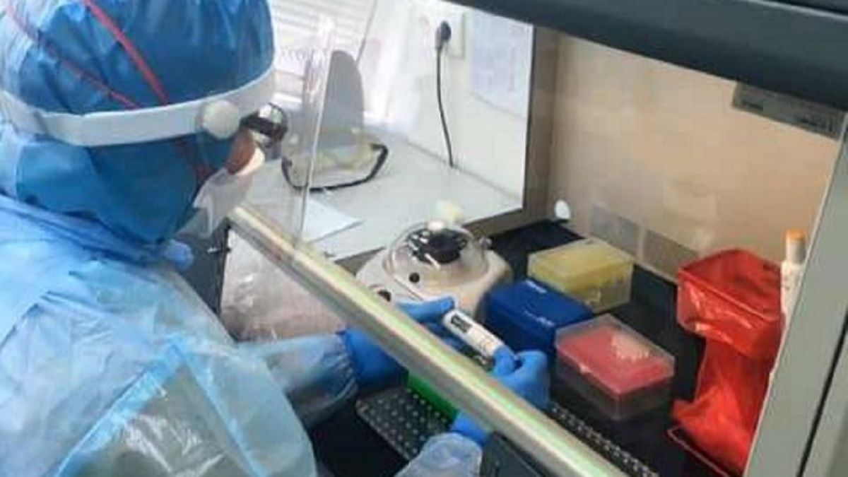 У лабораторіях Львова планують проводити до 500 ПЛР-досліджень за добу