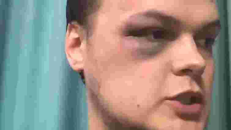 У Харкові побили журналіста після його заяви у поліцію про порушення карантину