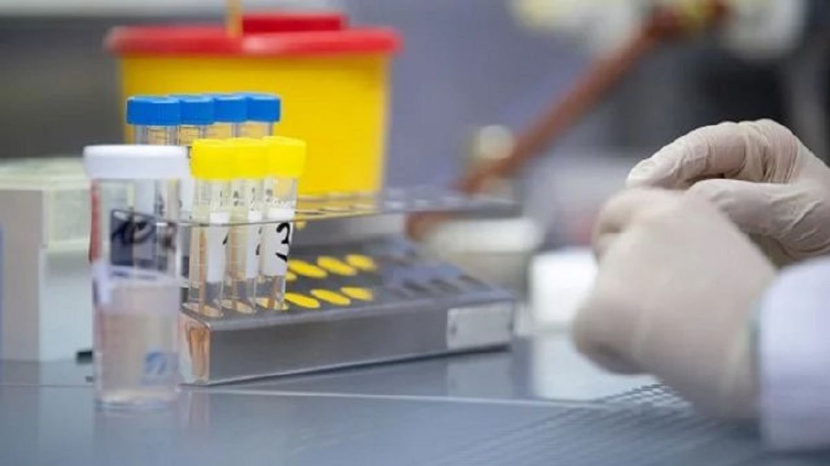 За добу львівські лабораторії роблять вже понад чотири сотні ПЛР-тестувань