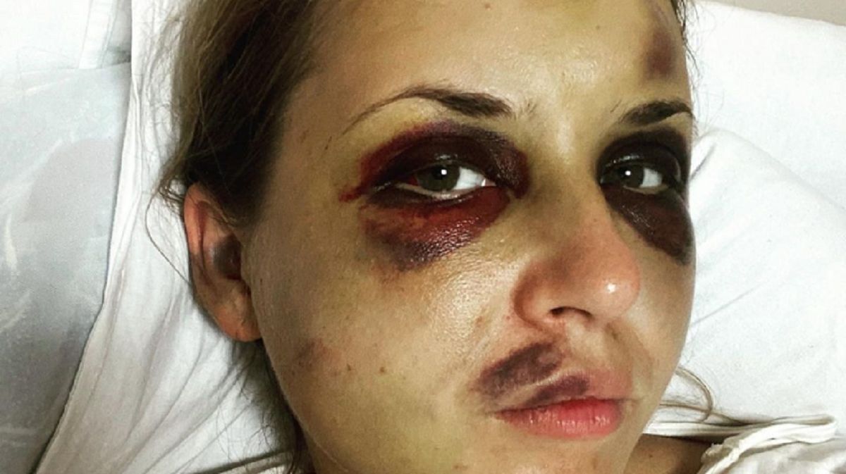 Побита пасажирка потяга «Київ – Маріуполь» розповіла подробиці нападу на себе