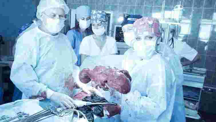 Львівські хірурги видалили в жінки 10-кілограмову пухлину, яка вросла в нирку