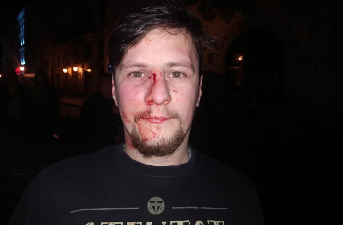 Двоє волонтерів заявили про напад поліцейських у центрі Львова
