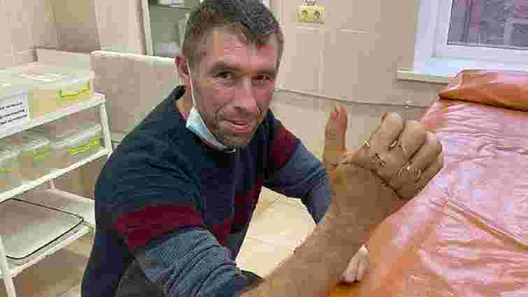 Львівські хірурги пришили 39-річному мешканцю Бродівщини відрізану циркуляркою руку