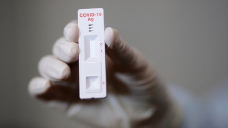 Україна отримала першу партію експрес-тестів на антиген Covid-19
