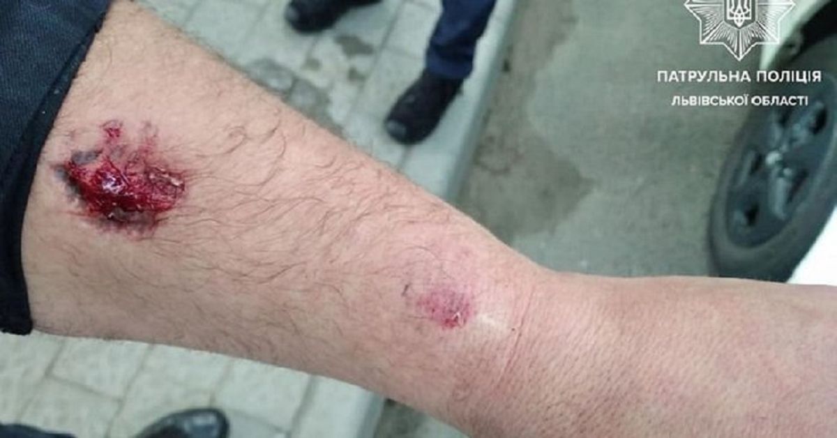 Суд звільнив від покарання п’яного водія, що вкусив поліцейського у Львові