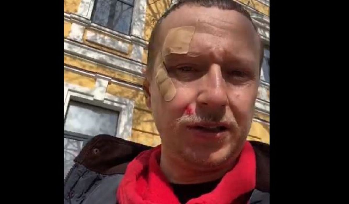 На телеведучого Романа Вінтоніва напали невідомі на самокатах