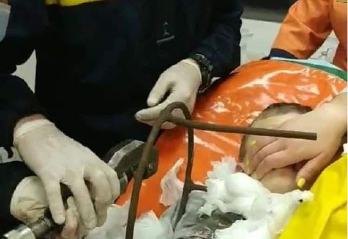 На Полтавщині 6-річний хлопчик проштрикнув шию металевим стільцем і вижив