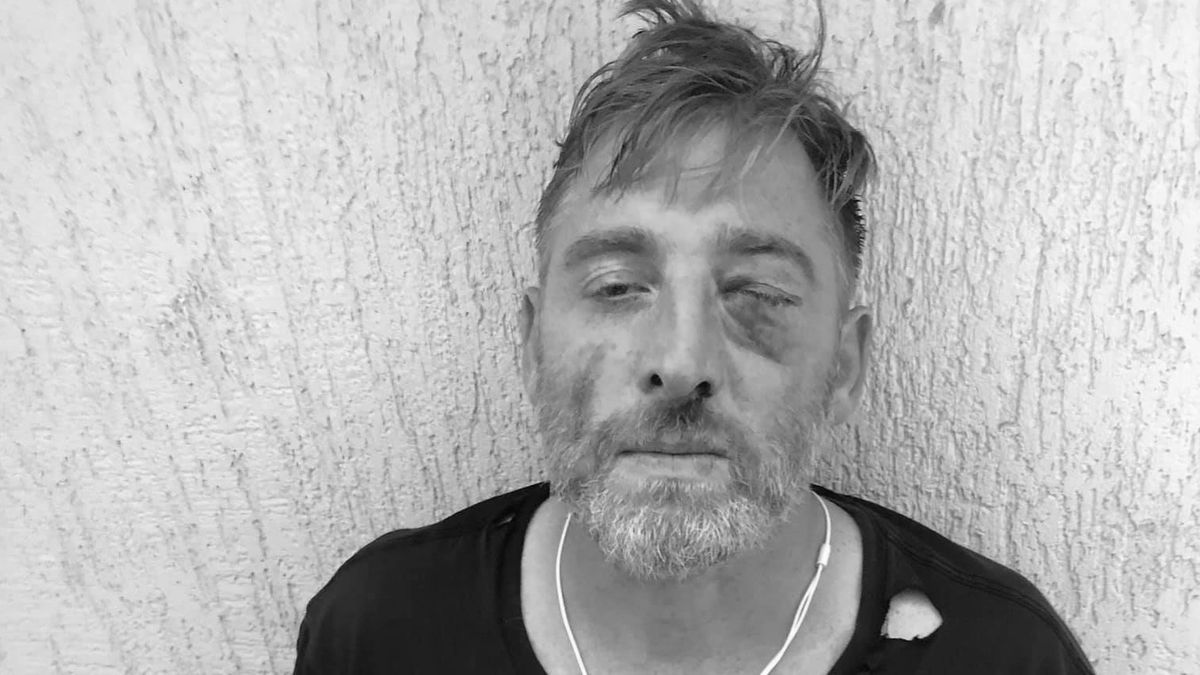 У Грузії помер телеоператор, якого побили противники ЛГБТ-маршу