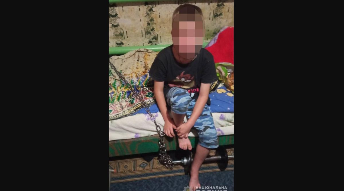 У Кривому Розі арештували вітчима, який тримав на ланцюгу 7-річну дитину 
