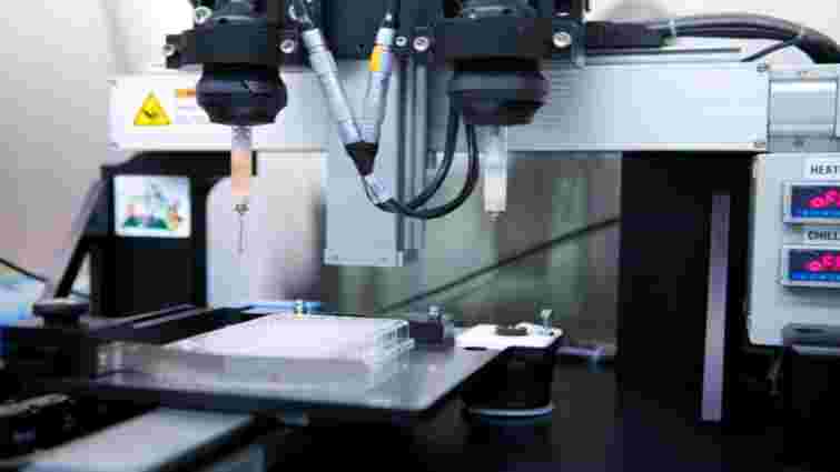 Чернівецькі лікарі вперше імплантували суглоб, виготовлений на 3D-принтері