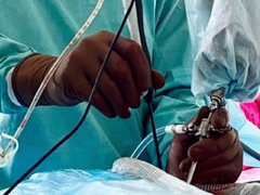 Кили дисків хребта: лікувати чи оперувати?