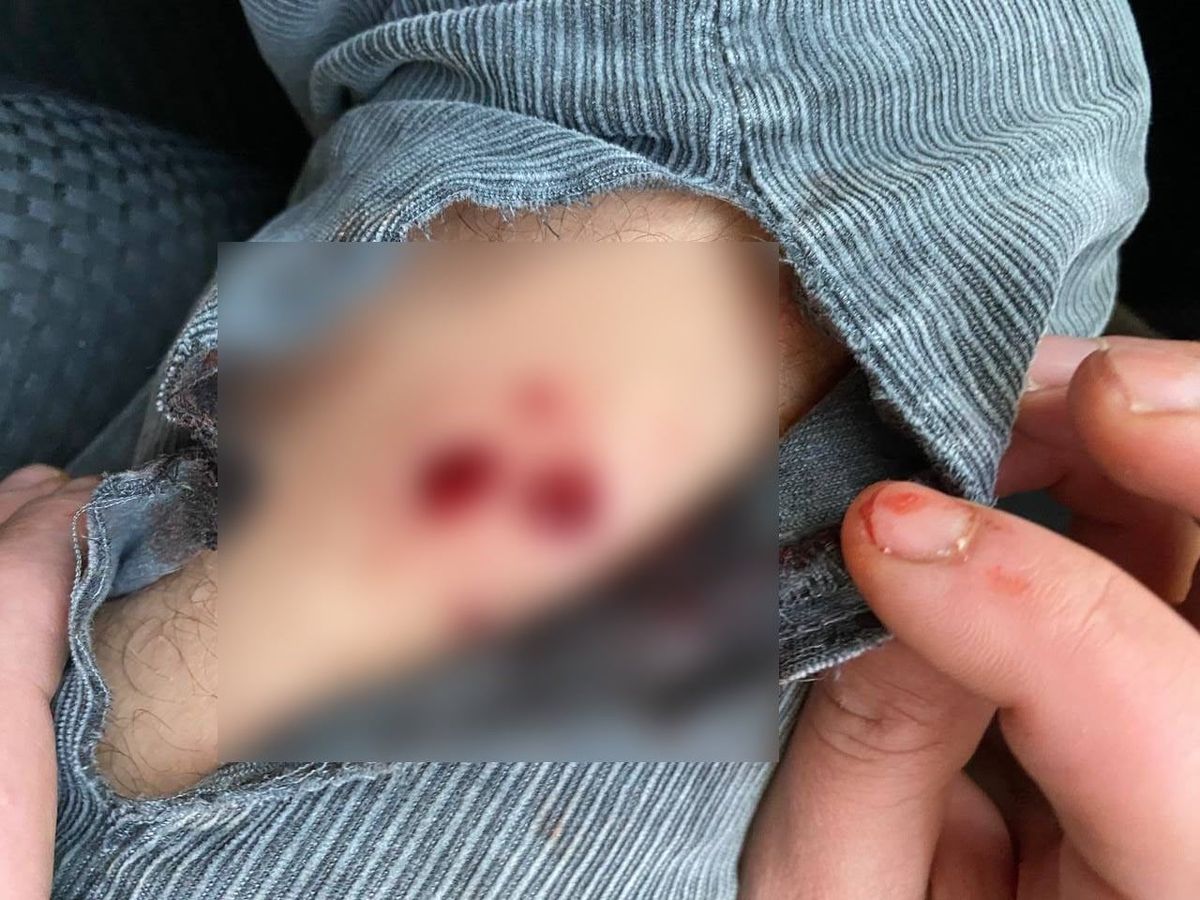 Під Києвом невідомий у камуфляжі розстріляв автомобіль з родиною